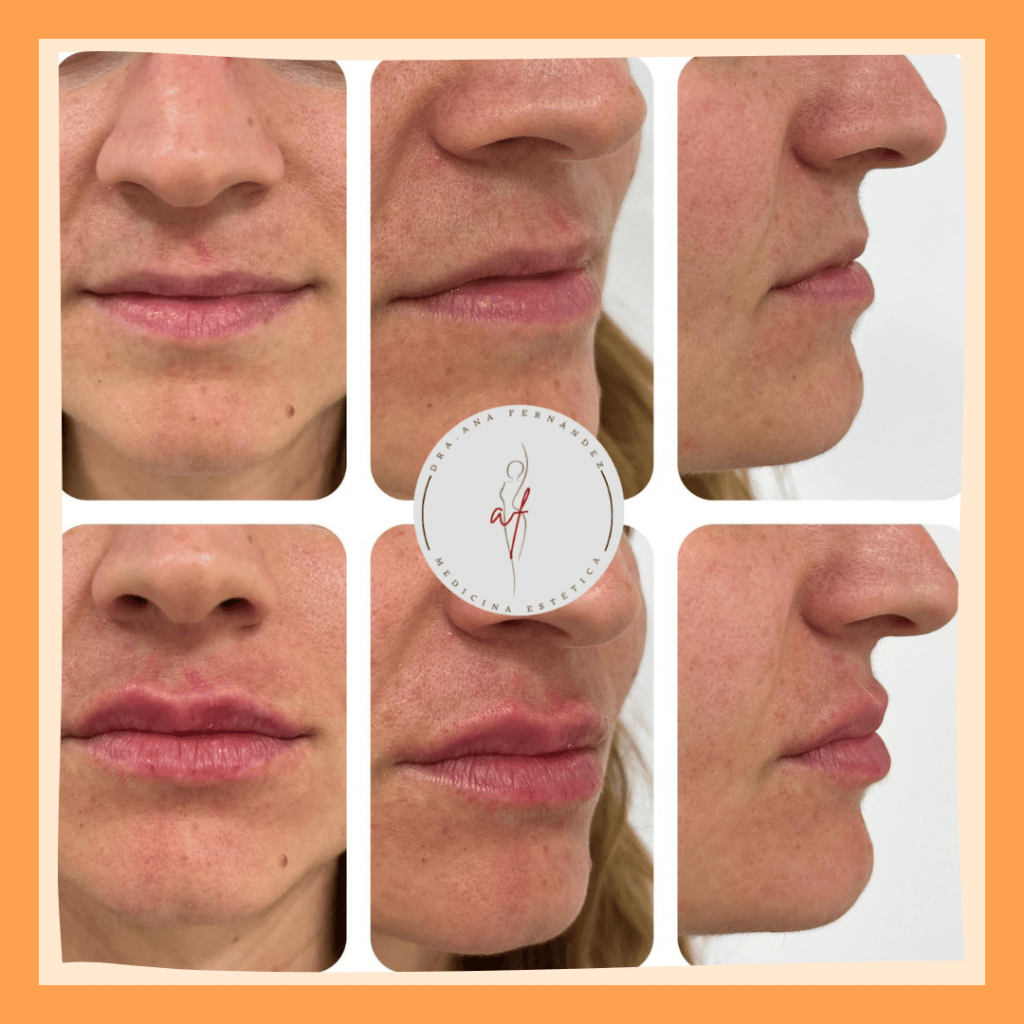 1 SESIÓN 1 HORA 1 TALLA MENOS (10)