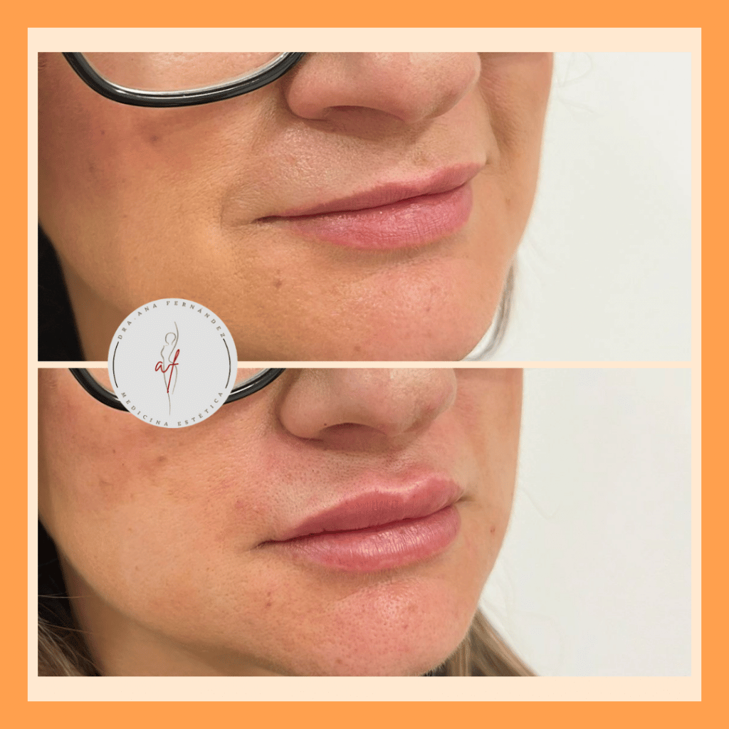 1 SESIÓN 1 HORA 1 TALLA MENOS (7)